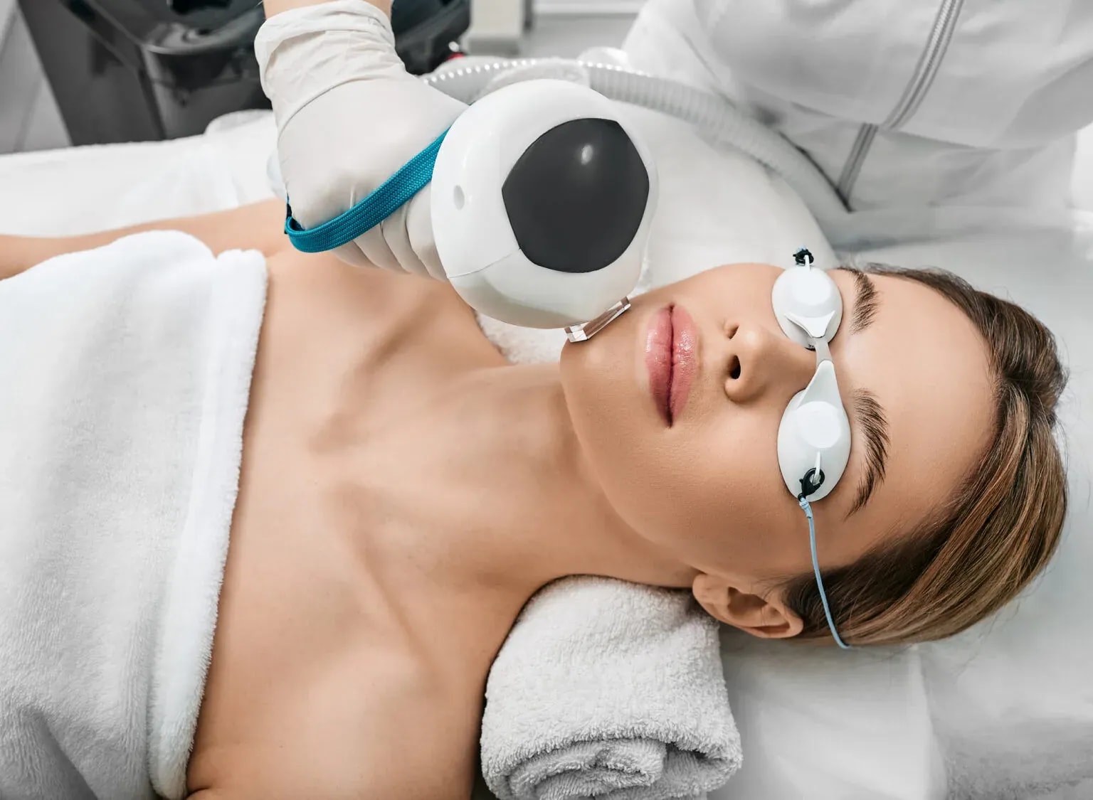 Photofacial (IPL)